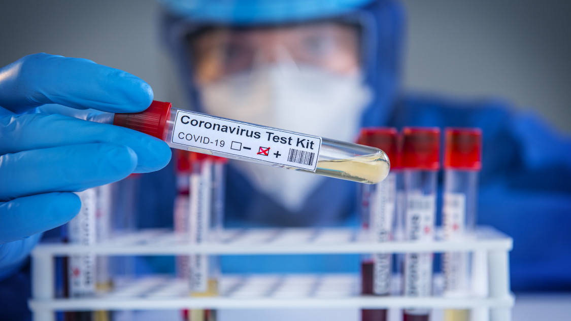 Májustól 17 ezer embert tesztelnek koronavírusra az ország egész területéről