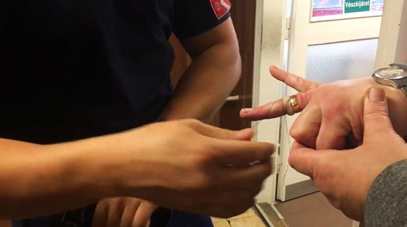 Tűzoltók szedték le a karikagyűrűt egy fehérvári nő ujjáról