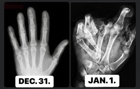 Petárdázni továbbra is tilos! - tűzijátékozni csak este 6 és reggel 6 között lehet