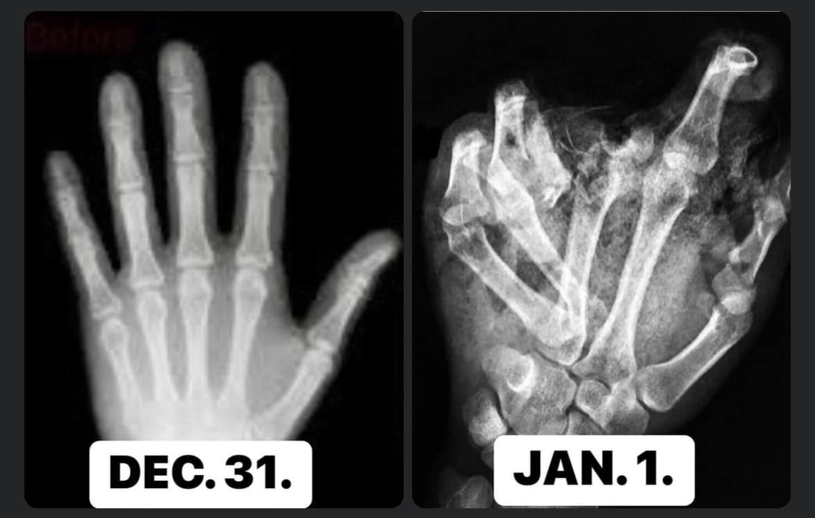 Petárdázni továbbra is tilos! - tűzijátékozni csak este 6 és reggel 6 között lehet