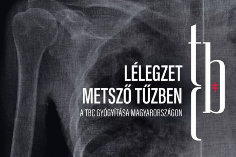A Szent György Kórházban is látható lesz a tuberkulózist bemutató vándorkiállítás